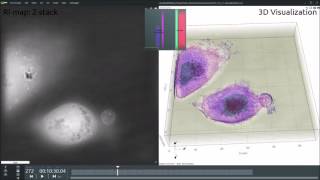 Living Tcell killing a living cancer cell [upl. by Ateiluj]