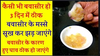 bawasir ka gharelu elaj in hindi बवासीर कैसे ठीक करें bawasir ke liye deshi nuskhadawai upaye [upl. by Clarie]