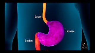 Endoscopia Digestiva Alta [upl. by Arabella]