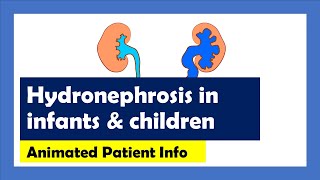 Hydronephrosis Explained Animated Patient Info [upl. by Ulrike454]