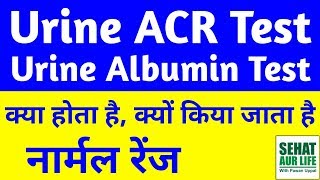 Urine ACR Test in Hindi Urine Albumin Test In Hindi Urine Albumin Normal Range [upl. by Lamej391]