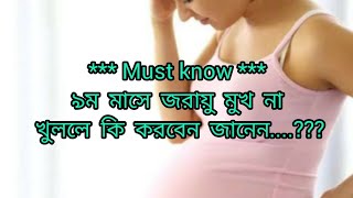 ৯ম মাসে জরায়ু মুখ না খুললে আপনার করনীয় Cirvix opening tips Sumonayesmingl5qv [upl. by Aleron9]