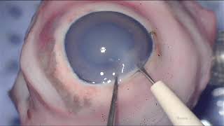 EXTRACAPSULAR CATARACT EXTRACTION  PIG EYES [upl. by Nyraf]