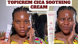 ALL YOU NEED TO KNOW ABOUT THE TOPICREM CICA SOOTHING CREAM  SKIN SENSITIVITY [upl. by Maryann]