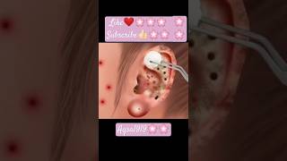 ASMR  Ear cleaning and removing Blackheads asmr animation asmr shorts [upl. by Hgielrebma]