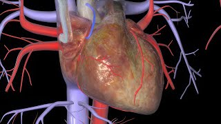 Heart Bypass Surgery CABG [upl. by Noiramaj]