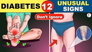 12 Unusual Symptoms of Diabetes  Diabetes Symptoms  Diabetes Mellitus   Diabetes Warning Signs [upl. by Socher]