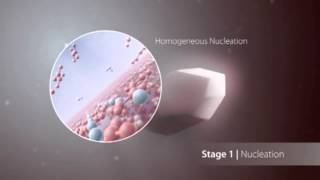 Kidney Stones in the Process of Formation in the Kidneys [upl. by Clive]