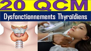 20 QCM Hyperthyroïdie ou Hypothyroïdie  Découvrez les Causes et Solutions [upl. by Eldwin523]