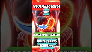 Neusmaagsonde  Tips and Tricks 1 [upl. by Dranyar]