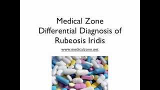 Medical Zone  Differential Diagnosis of Rubeosis Iridis [upl. by Nobel317]