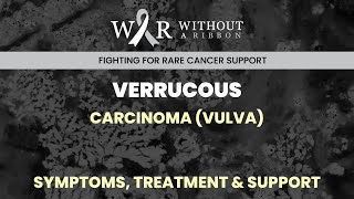 VERRUCOUS CARCINOMA VULVA – SYMPTOMS TREATMENT amp SUPPORT [upl. by Ynots]