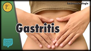 Gastritis Was tun wenn der Magen sich selbst schädigt [upl. by Drona]