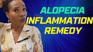 Alopecia Remedy What to do if you have inflammation [upl. by Adianez416]