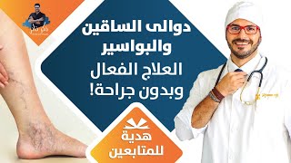 علاج البواسير و دوالي الساقين النهائي بدون جراحة بطريقة فعالة [upl. by Elawalo]