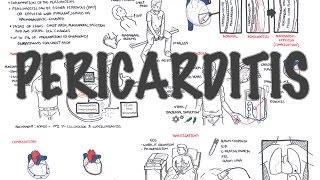 Pericarditis  Overview signs and symptoms pathophysiology diagnosis treatment [upl. by Sill]