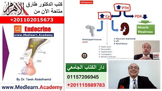 Hyperparathyroidism cme internalmedicine usmle medical محاضراتباطنة [upl. by Tsiuqram]