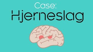 Case 5 Hjerneslag [upl. by Edmea]