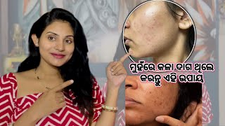 Reduce your Darkspots by following these Easy tips  Skincare  Sradhapanigrahi [upl. by Sherborne]