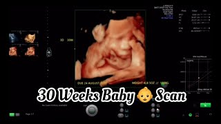 30 Weeks Pregnancy Baby Scan Ultrasound Movement [upl. by Xylina]