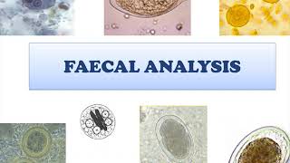 FAECAL ANALYSIS  In Brief [upl. by Ahseyt]