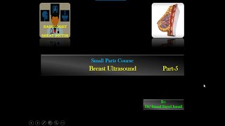 Breast Ultrasound Part5 Technique [upl. by Dorelle647]