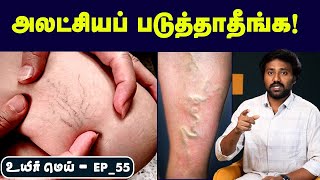 Vericose Vein ரொம்ப நேரம் நிப்பீங்களா  Positionஅ இப்டி மாத்துங்க  Uyirmei EP55 [upl. by Enilorac]