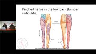 Bulging discs Causes Symptoms and Treatment Options [upl. by Lleirbag672]