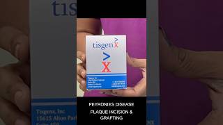 Peyronie’s disease treatment  plaque incision with grafting peyroniesdisease [upl. by Jaela]