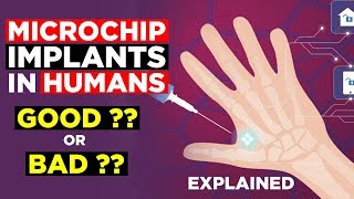 Microchip Implant In Humans  Is Microchip Implantation in Human Body Safe  EXPLAINED 2019 🔥🔥 [upl. by Notsniw]