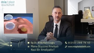 Meme Büyütme Ameliyatları  Op Dr Arda Katırcıoğlu [upl. by Kantos]