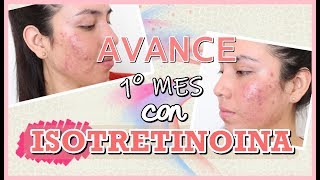 DIARIO DE MI ACNE  PRIMER MES CON ISOTRETINOINA  LizQuintana [upl. by Lussier]