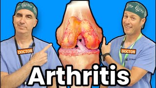 Treating Knee Arthritis Without Surgery [upl. by Anilatsyrc312]