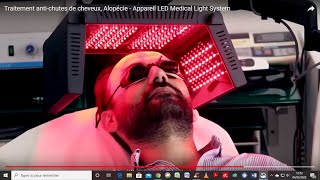 Traitement antichute stimulation de la pousse des cheveux alopécie  appareil LED MLS Dr Beilin [upl. by Acinat730]