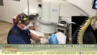 Translaminar Epidural Steroid Injections [upl. by Kenelm487]