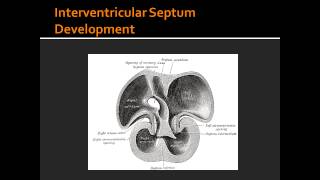 Interventricular Septum Development [upl. by Gnik230]