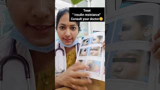 Read the description drdivya doctor drdivyat acanthosisnigricans darkneck healthtipinkannada [upl. by Javier]