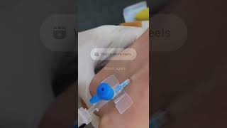 IV cannula insertiondoctornursingmotivationshortvideoviralvideo [upl. by Hanala]