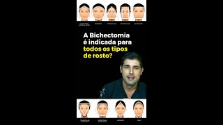 A BICHECTOMIA É INDICADA PARA TODOS OS TIPOS DE ROSTO [upl. by Gillead]