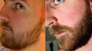 How to Dye your PATCHY BEARD  Fuller Beard Appearance  YEARD WEEK 8 [upl. by Pearla]