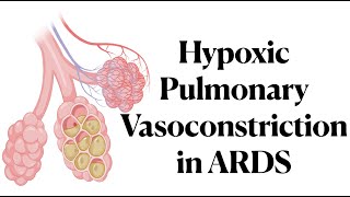 Hypoxic Pulmonary Vasoconstriction in ARDS [upl. by Gaither]