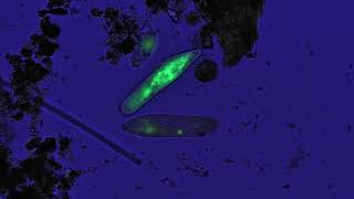 Freshwater ciliates stained acridine orange [upl. by Minda]