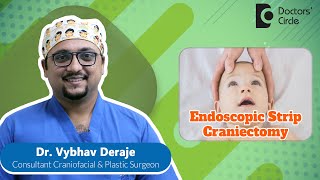 Endoscopic Strip Craniectomy amp Helmet Therapy craniosynostosis  Dr Vybhav Deraje Doctors Circle [upl. by Fin]