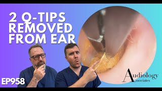 2 QTIPS REMOVED FROM EAR  EP958 [upl. by Nnaul605]