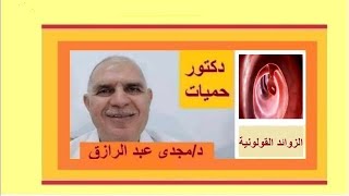 الزوائد القولونية والأورام الحميدة [upl. by Hosbein]