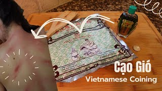 Cao Gio The Practice of Vietnamese Coining [upl. by Eyks139]