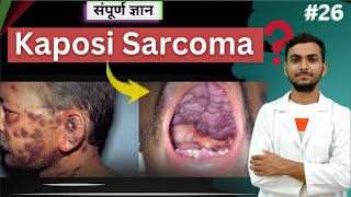 quotUnderstanding Kaposi Sarcoma Symptoms Causes and Treatmentquot cancer viralinfection Mltwallah [upl. by Benco337]