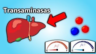 Transaminasas Altas EXPLICACIÓN EN 5 MINUTOS  Patología Clínica101 [upl. by Primrosa]