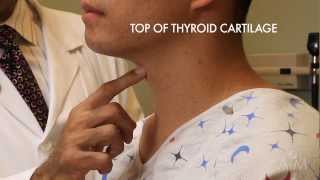 The Thyroid Exam Stanford Medicine 25 [upl. by Ahsenik]