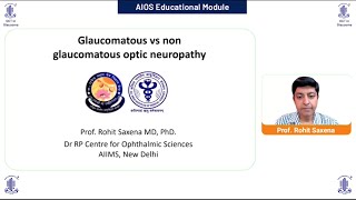 NonGlaucomatous Atrophy  Dr Rohit Saxena [upl. by Hamal]